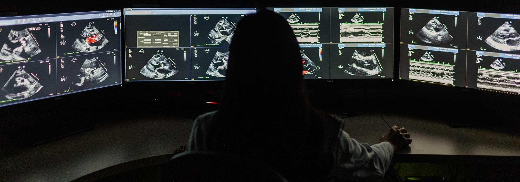 Dr. Christina Luong AI Echo Core Lab in front of multiple computer screens